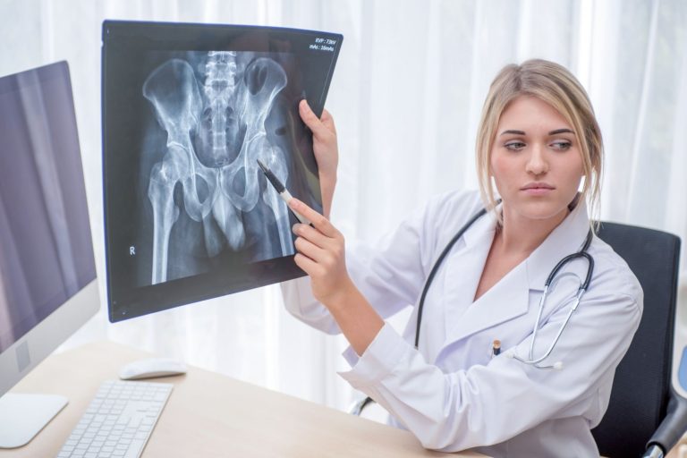 Sharing My Story: Raising Awareness about Bone Cysts and Advocating for Better Care