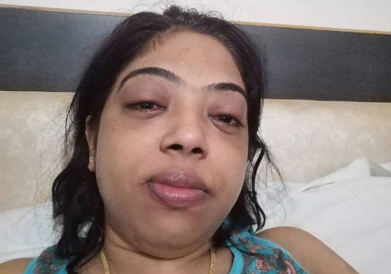 Fueling Strength: Championing KRN Mahapatra’s Battle Against AVN